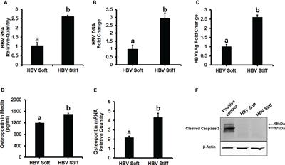 Increased liver stiffness promotes hepatitis B progression by impairing innate immunity in CCl4-induced fibrotic HBV+ transgenic mice